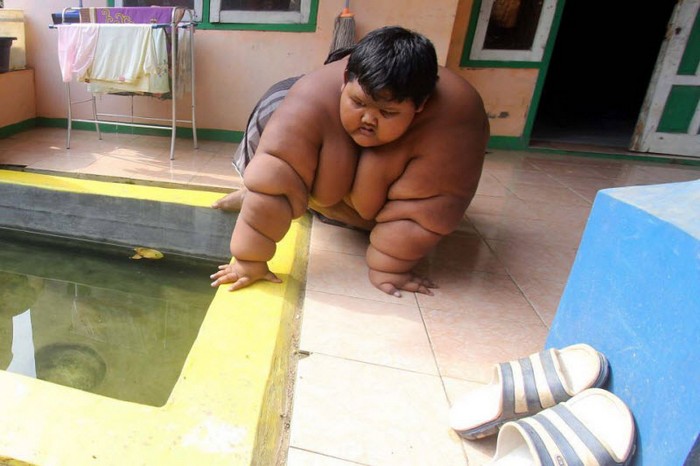 Самый толстый мальчик в мире (9 фото)