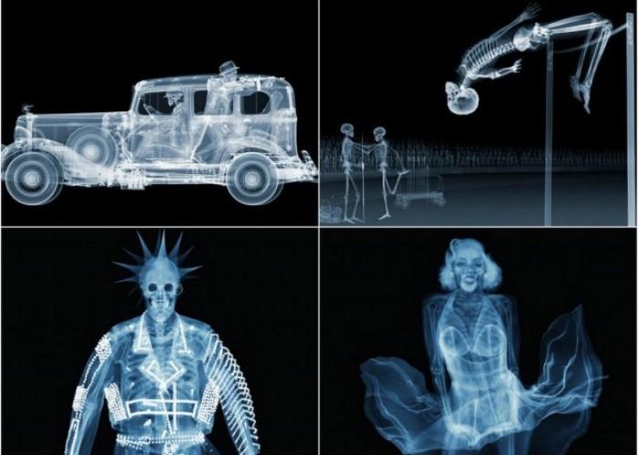 Удивительные рентгеновские фотографии Ника Визи (40 фото)